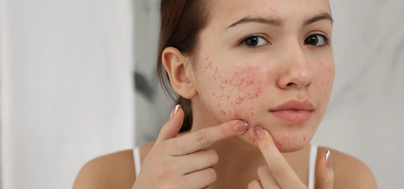 allergies-banner